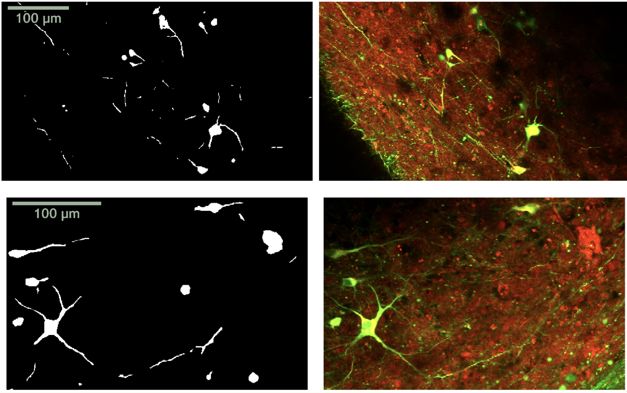 Example neuron segmentation masks.